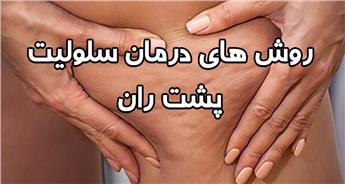 درمان سلولیت پشت ران