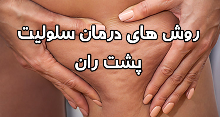درمان سلولیت پشت ران