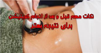 مراقبت های قبل و بعد از کویتیشن برای نتیجه بهتر