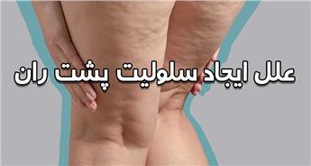 علت ایجاد سلولیت پشت ران